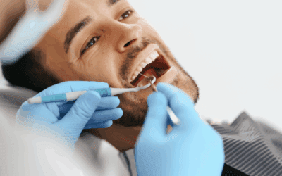 Endodonzia e Conservativa: Combattere le Carie e Quando È Necessaria la Devitalizzazione