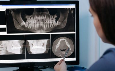 Protesi Dentarie: L’Armonia di Estetica e Funzionalità con Materiali Innovativi